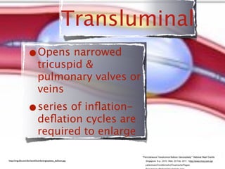 Transluminal
                  •Opens narrowed
                            tricuspid &
                            pulmonary valves or
                            veins
                  •series of inﬂation-
                            deﬂation cycles are
                            required to enlarge

                                                            "Percutaneous Transluminal Balloon Valvuloplasty." National Heart Centre
http://img.tfd.com/dorland/thumbs/angioplasty_balloon.jpg      Singapore. N.p., 2010. Web. 20 Feb. 2011. <http://www.nhcs.com.sg/
                                                               patientcare/ConditionsAndTreatments/Pages/
 