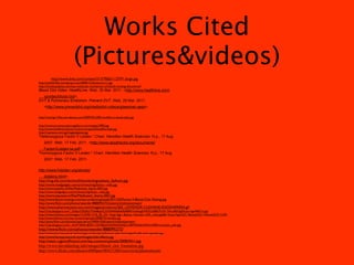 Works Cited
                           (Pictures&videos)
         http://www.bmj.com/content/313/7065/1127/F1.large.jpg
http://spl225.ﬁles.wordpress.com/2009/12/dictionary11.jpg
http://trendsupdates.com/key-molecular-mechanism-of-blood-clotting-discovered/
Blood Clot Video. HealthLine. Web. 30 Mar. 2011. <http://www.healthline.com/
  vpvideo/blood-clot>.
DVT & Pulmonary Embolism. Prevent DVT. Web. 29 Mar. 2011.
    <http://www.preventdvt.org/media/dvt-videos/glassman.aspx>.

http://raisingrrl.ﬁles.wordpress.com/2009/02/o005-buddha-w-beads-jade.jpg

http://www.ancientsculpturegallery.com/images/2982.jpg
http://www.buddhistchannel.tv/picture/upload/buddha-leafs.jpg
http://topnews.com.sg/images/genes.jpg
"Heterozygous Factor V Leiden." Chart. Hamilton Health Sciences. N.p., 17 Aug.
    2007. Web. 17 Feb. 2011. <http://www.stoptheclot.org/documents/
   FactorVLeiden-lw.pdf>.
"Homozygous Factor V Leiden." Chart. Hamilton Health Sciences. N.p., 17 Aug.
    2007. Web. 17 Feb. 2011.

http://www.fvleiden.org/stories/
   dobbins.html>.
http://img.tfd.com/dorland/thumbs/angioplasty_balloon.jpg
http://www.medgadget.com/archives/img/Stent---side.jpg
http://www.topnews.in/ﬁles/Medicated_Stents.2007.jpg
http://www.medgadget.com/archives/img/Stent---side.jpg
http://www.topnews.in/ﬁles/Medicated_Stents.2007.jpg
http://www.factorvracing.com/wp-content/uploads/2011/02/Factor-V-Blood-Clot-Testing.jpg
http://www.ﬂickr.com/photos/veender/888095272/sizes/o/in/photostream/
http://www.pharmacyescrow.com/images/products/265_LOVENOX-CLEXANE-ENOXAPARIN.gif
http://3.bp.blogspot.com/_GsSpcCFkJdU/THw8xphCZtI/AAAAAAAABPA/VxbleyglVMU/s1600/75101154.caBX2gDb.syringe44671s.jpg
http://www.freefoto.com/images/1216/05/1216_05_54---Stop-Sign--Beatty--Nevada--USA_web.jpg?&k=Stop+Sign%2C+Beatty%2C+Nevada%2C+USA
http://www.fulloma.com/wp-content/uploads/2008/10/needles.jpg
http://www.ﬂickr.com/photos/captcuervo/740941026/sizes/z/in/photostream/
http://2.bp.blogspot.com/_4m3YdPyfLv8/SKr12hNfEpI/AAAAAAAAELw/BFMHzbbvNAU/s400/coumadin_pills.jpg
http://www.ﬂickr.com/photos/veender/888095272/
http://www.pharmaceutical-technology.com/projects/brecon-pharma/images/4-pills-and-capsules.jpg
http://www.funnypostcard.com/images/side-effects.jpg
http://static.ragamufﬁnsoul.com/wp-content/uploads/2008/04/rr.jpg
http://www.daviddarling.info/images/blood_clot_formation.jpg
http://www.ﬂickr.com/photos/r000pert/80415260/sizes/m/in/photostream/
 