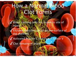 How a Normal Blood
                                Clot Forms
                       ✓Blood clotting cells are drawn to site of
                                injury.

                       ✓Enzyme reactions occur on the surface of
                                the platelets

                       ✓Activated Protein C inactivates factor V
                       ✓Clot remains in place
Ornstein, Deborah L., and Mary Cushman. "Factor V Leiden." Circulation: Journal
                                                                                  http://www.daviddarling.info/images/
   of the American Heart Association (2003): n. pag. Print.
                                                                                        blood_clot_formation.jpg
 