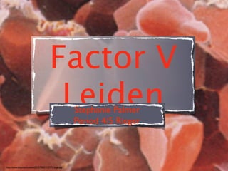 Factor V
                                          Leiden        Stephanie Palmer
                                                        Period 4/5 Rieger



http://www.bmj.com/content/313/7065/1127/F1.large.jpg
 