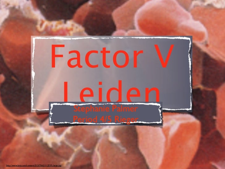 Factor V Leiden