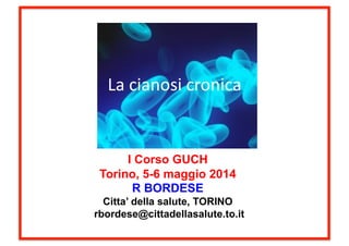 La	
  cianosi	
  cronica	
  
I Corso GUCH
Torino, 5-6 maggio 2014
R BORDESE
Citta’ della salute, TORINO
rbordese@cittadellasalute.to.it
 