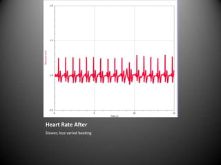 Heart Rate AfterSlower, less varied beating