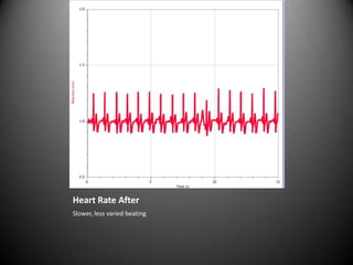 Heart Rate After<br />Slower, less varied beating<br />