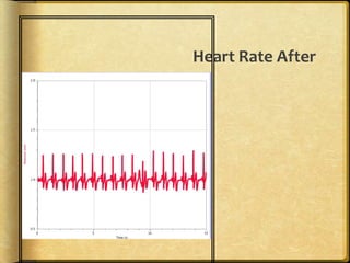 Heart Rate After