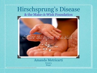 Hirschsprung’s Disease
                                                       & the Make-A-Wish Foundation




                                                                                     Amanda Metricarti
                                                                                                Period 9
                                                                                                 Rieger
http://www.wish.org/var/wish_user/storage/original/image/e8d70669a91b9456b72432fe262c204b.jpg
 