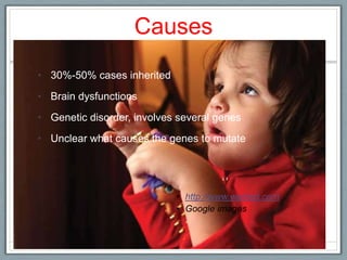 Causes 30%-50% cases inheritedBrain dysfunctionsGenetic disorder, involves several genes Unclear what causes the genes to mutate http://www.webmd.comGoogle images