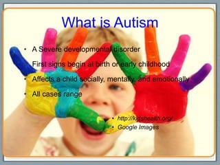 What is Autism A Severe developmental disorderFirst signs begin at birth or early childhoodAffects a child socially, mentally, and emotionallyAll cases range http://kidshealth.org/Google Images