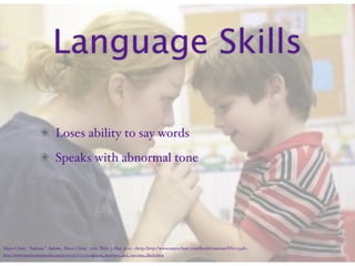 Language Skills

                           Loses ability to say words
                           Speaks with abnormal tone




Mayo Clinic. “Autism.” Autism. Mayo Clinic, 2011. Web. 3 Mar. 2011. <http:/‌http://www.mayoclinic.com/‌health/‌autism/‌DS00348>.
http://www.masternewmedia.org/news/2007/05/19/autism_mercury_and_vaccines_likely.htm
 
