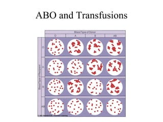 ABO and Transfusions 