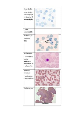 H007 identify normal and abnormal erythrocyte, platelet and leucocytes ...