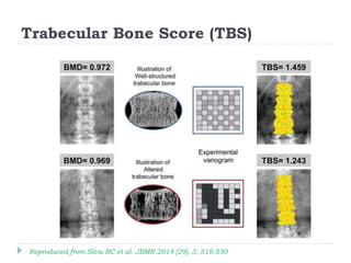 Tbs Reference Chart Osteoporosis 2016 | DXA and beyond: Dr Nicola Crabtree #osteo2016 | PPTX