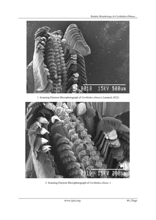 Radula Morphology In Cerithidea Obtusa…
www.ijesi.org 46 | Page
1. Scanning Electron Microphotograph of Cerithidea obtusa ( Lamarck,1822)
2. Scanning Electron Microphotograph of Cerithidea obtusa (
 
