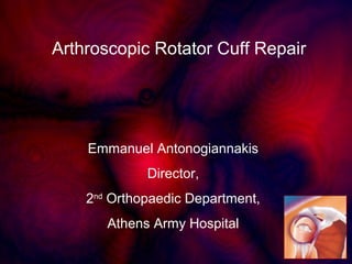 Emmanuel Antonogiannakis
Director,
2nd
Orthopaedic Department,
Athens Army Hospital
Arthroscopic Rotator Cuff Repair
 