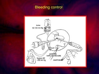 Bleeding control
 