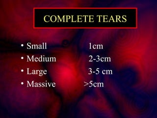 COMPLETE TEARS
• Small 1cm
• Medium 2-3cm
• Large 3-5 cm
• Massive >5cm
 