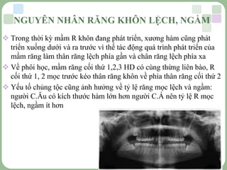 LOGO
 Trong thời kỳ mầm R khôn đang phát triển, xương hàm cũng phát
triển xuống dưới và ra trước vì thế tác động quá trình phát triển của
mầm răng làm thân răng lệch phía gần và chân răng lệch phía xa
 Về phôi học, mầm răng cối thứ 1,2,3 HD có cùng thừng liên bào, R
cối thứ 1, 2 mọc trước kéo thân răng khôn về phía thân răng cối thứ 2
 Yếu tố chủng tộc cũng ảnh hưởng về tỷ lệ răng mọc lệch và ngầm:
người C.Âu có kích thước hàm lớn hơn người C.Á nên tỷ lệ R mọc
lệch, ngầm ít hơn
NGUYÊN NHÂN RĂNG KHÔN LỆCH, NGẦM
 