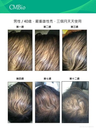 僅供教育訓練使用
男性 / 40歲，嚴重雄性禿，三個月天天使用
第七週
第一週 第二週 第三週
第四週 第十二週
 