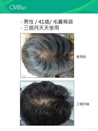 僅供教育訓練使用
‧ 男性 / 41歲/ 毛囊稀疏
‧ 三個月天天使用
使用前
三個月後
 