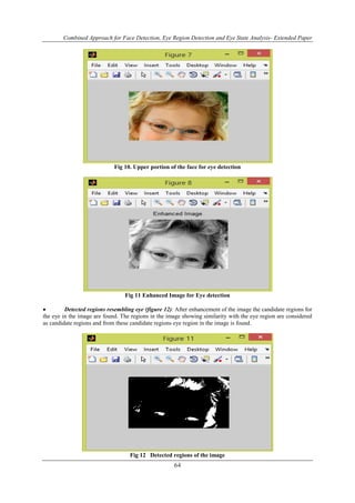 Combined Approach for Face Detection, Eye Region Detection and Eye State Analysis- Extended Paper 
Fig 10. Upper portion of the face for eye detection 
Fig 11 Enhanced Image for Eye detection 
 Detected regions resembling eye (figure 12): After enhancement of the image the candidate regions for 
the eye in the image are found. The regions in the image showing similarity with the eye region are considered 
as candidate regions and from these candidate regions eye region in the image is found. 
Fig 12 Detected regions of the image 
64 
 