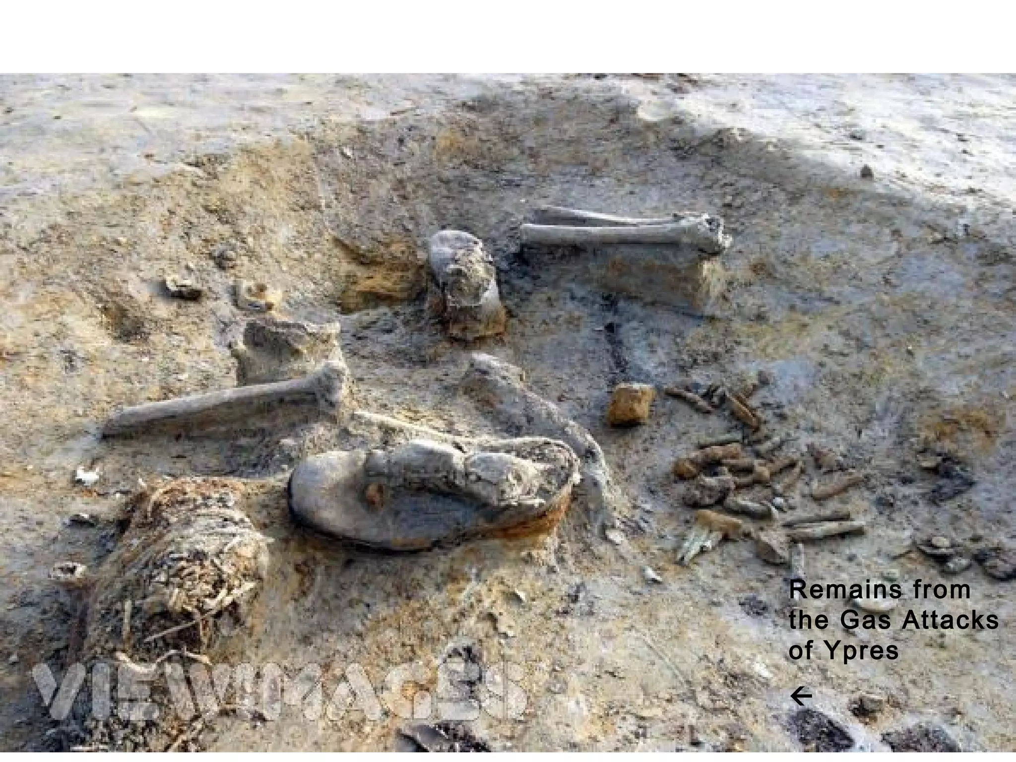 Remains from
the Gas Attacks
of Ypres

 