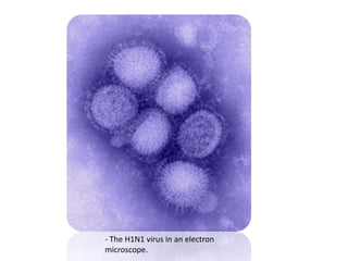 - The H1N1 virus in anelectronmicroscope. 