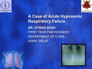 A Case of Acute Hypoxemic
Respiratory Failure
DR. VITRAG SHAH
FIRST YEAR FNB RESIDENT,
DEPARTMENT OF CCEM,
SGRH, DELHI
 