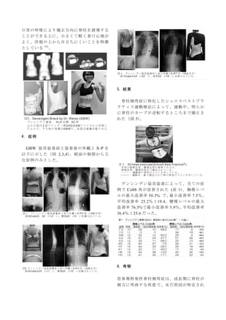 日常の呼吸により矯正方向に脊柱を誘導する
ことができる上に、小さくて軽く着け心地が
よく、洋服の上から目立ちにくいことを特徴
としている 10）
。
4．症例
GBW 装具装着前と装着後の外観と X-P を
以下に示した（図 2,3,4）。紙面...