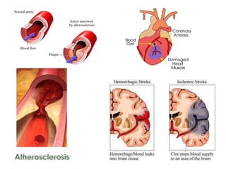 HerbicidesJune 19, 2002You’re on Doctors’ Order:After decades, the AMERICAN MEDICAL ASSOCIATION made a 180° turn.  They all agreed and finally decided. “We Recommend ALL ADULTS to Take Vitamin Supplements Daily”“(RDA) Enough fruits & vegetable to prevent deficiency, but not enough to prevent disease”“Low levels of Antioxidant Vitamins may increase risk of several chronic diseases.”Journal of the American Medical Association 2002; 287: 3127-3129