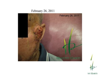 ChlorophyllHemoglobin