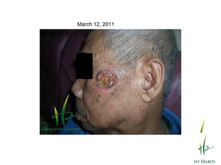 Sun shining on Wheatgrass creating Chlorophyll