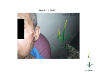 The Effects of Wheatgrass andBarley Grass