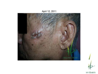 Soluble fiber metabolizes fat, cholesterol and carbohydrates.