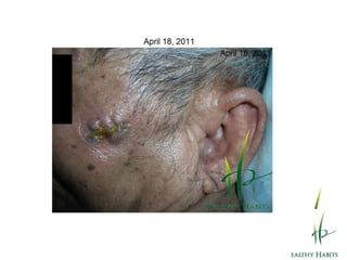 Arginine(Amino Acid) helps keep blood vessels elastic so blood flows smoothly.