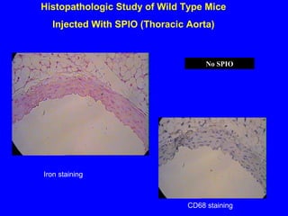 Histopathologic Study of Wild Type Mice
Injected With SPIO (Thoracic Aorta)
CD68 staining
Iron staining
No SPIO
 