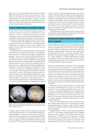 portals in order to assess and address specific pathology. The Distal
RadioUlnar Joint (DRUJ)[3]
and the ulnar fovea portals[4]
require
using a 1.9 mm arthroscope for viewing and are specific to ulnar
sided pathology. The volar radial portal[5]
requires a mini open
approach through the sheath of the Flexor Carpi Radialis for safety
reasons, can assess dorsal ligaments and capsule pathology and is
also used in some reconstructive procedures.
CARPAL INTEROSSEOUS LIGAMENTS LESIONS
Current concepts in wrist instability increasingly recognize the
significant contribution of extrinsic carpal ligaments in this
pathology[6,7]
, however, addressing the interosseous (usually
Scapholunate (SL) or Lunotriquentral (LT) ligaments) lesion is
considered the essential element of treatment[8]
. Wrist arthroscopy is
a valuable tool in diagnosing, staging and treatment of these lesions.
SL ligaments lesions are categorized as acute (within 3 months
from injury) or chronic and the Geissler[9]
or the Dreant/Dautel[10]
staging systems are usually used. The resultant instability can be
dynamic (observed only with loading of the wrist in grip view
radiographs) or static[11]
.
Acute partial tears of the membranous portion of the SL ligament
(Geissler type I) are thought to be amenable to immobilization
alone. There may be a biomechanical advantage in immobilizing in
supination[7]
. In more extensive lesions involving the dorsal part of
the ligament the chances of chronic instability become greater. In
such lesions (Gessler type II and III) scapholunate interval stability
should be assessed from a midcarpal portal as well. Reduction and
temporary pinning of the SL interval is the treatment of choice of
these lesions and is supplemented with mechanical debridement or
radiofrequency probe thermal shrinkage of the ligament[12]
(Figure
1). However, overzealous use of radiofrequency probes in the wrist
is to be avoided[13]
. When a patient presents with gross SL instability
(Geissler type IV, positive "drive through" sign) there usually is a
complete SL ligament tear and consideration should be give to open
repair with suture anchors. There have been reports of arthroscopic
assisted complete SL ligament tear repair (either dorsal[14,15]
or
volar[5]
) but at this point open repair is considered the gold standard.
In chronic SL lesions pronated grip view radiographs are essential
Darlis NA et al. Wrist Arthroscopy Review
53 © 2014 ACT. All rights reserved.
as well, it remains an option for patients that prefer a less invasive
treatment. When faced with static instability the aforementioned open
techniques are usually utilized. New techniques and modifications
of older ones keep appearing in the literature demonstrating the
complexity of this problem. The RASL technique involves placing
a compression screw between the scaphoid and the lunate and
arthroscopic assistance has been reported[17]
with this technique.
More recently, an SL tenodesis using an interference screw and
arthroscopic assistance (the SLAM procedure) has been reported[18]
but clinical experience is limited.
LT ligament lesions are less common and can be treated with the
same principles but the possibility of their being a result of ulnocarpal
impingement syndrome must be kept in mind[8]
.
TRIANGULAR FIBROCARTILAGE COMPLEX
(TFCC) LESIONS
The long recognized role of the TFCC in load transmission across the
ulnar side of the wrist and distal radioulnar joint (DRUJ) stability[19]
has been revisited in recent years. The main structures responsible
for DRUJ stability have been shown to be the Volar and Dorsal
Radioulnar Ligaments (VRUL, DRUL) and more importantly the
firm attachment of the TFCC to the fovea of the ulnar head[20]
.
Nakamura’s biomechanical “hammock” paradigm[19]
has evolved into
the “iceberg” paradigm[20]
in which the biomechanically important
foveal attachment is below the surface of what we can see in classic
radiocarpal arthroscopy. Repair of the foveal attachment of the TFCC
is considered essential in young active patients.
Similarly, the traditional Palmer classification[21]
has been challenged
in recent years by newer classifications[20,21]
which incorporate the
new biomechanical concepts and arthroscopic findings. However the
basic distinction between type I (traumatic) and type II (degenerative)
lesions of the Palmer classification still stands, as the later
(degenerative) are frequently observed in ulnocarpal impingement
syndrome and consideration must be given to an ulnar recession
procedure. A more practical classification approach is based on the
location of the tear with central, radial and peripheral (ulnar) tears
being described. Ulnar tears can involve tear of the foveal attachment
of the TFCC.
Central TFCC lesions are often degenerative and can be treated
with arthroscopic debridement of as much as two thirds of the
central disc[22]
. In these patients consideration must be given to the
coexistence of ulnocarpal impingement (using pronated grip view
radiographs and/or MRI). If that diagnosis is established ulnar
shortening by a few millimeters must be performed. This can be
done in an intrarticular arthroscopic manner (Wafer procedure)
[23]
in modest shortenings or extrarticular open using one of several
described techniques[24]
.
Tears of the radial attachment of the TFCC are uncommon and
their treatment remains controversial[25]
. It seems that they should be
repaired using transosseous techniques if they involve the insertion
of the VRUL or the DRUL and they cause DRUJ instability. All other
tears can be debrided.
Peripheral (ulnar) tears usually involve the dorso-ulnar attachment
of the TFCC, have adequate vascular perfusion and are considered
repairable within an optimal 3 to 6 month time frame from the
original injury[25]
. With these lesions it is important to recognize
possible detachment of the deep fibers to the ulnar fovea. MRI
and arthroscopic findings (positive probe test, arthroscopy of the
undersurface of the TFCC) can be helpful in that respect. If the
Figure 1 Partial scapholunate (SL) ligament tear before (left) and after
(right) debridement and thermal shrinkage with a radiofrequency probe
(RF). S: scaphoid; L:lunate.
to diagnose dynamic instability. Chronic symptomatic partial tears
without instability respond well to arthroscopic debridement or
thermal shrinkage[12]
. In cases with partial lesions and dynamic
instability several open techniques have been described (capsulodesis,
tenodesis, partial arthrodesis) with suboptimal results[8]
. Another
option is an aggressive arthroscopic debridement and pinning of the
SL interval[16]
. With results with this technique being suboptimal
 