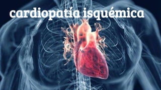 cardiopatía isquémica
 