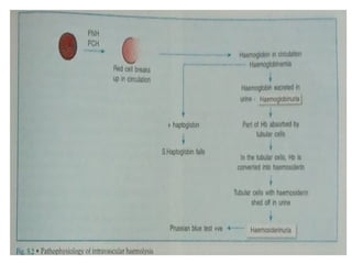 Normocytic normochromic anaemia Hemolytic anaemia | PPT