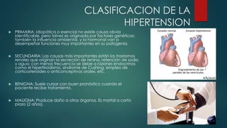 CLASIFICACION DE LA
HIPERTENSION


PRIMARIA: idiopática o esencial no existe causa obvia
identificable, pero talvez es originada por factores genéticos;
también la influencia ambiental, y la hormonal van a
desempeñar funciones muy importantes en su patogenia.



SECUNDARIA: Las causas más importantes están los trastornos
renales que originan la secreción de renina, retención de sodio
y agua; con menos frecuencia se debe a razones endocrinos
como el hipertiroidismo, síndrome de Cushing, empleo de
corticosteroides o anticonceptivos orales, etc.



BENIGNA: Suele cursar con buen pronóstico cuando el
paciente recibe tratamiento.



MALIGNA: Produce daño a otros órganos. Es mortal a corto
plazo (2 años).

 