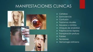 MANIFESTACIONES CLINICAS














Cefaleas
Somnolencia
Confusión
Trastornos visuales
Nauseas y vómitos
Ataques de ansiedad
Palpitaciones rápidas
Transpiración profusa
Palidez
Temblores
Hemorragia retiniana

 