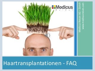 Haartransplantationen - FAQ
MedicusReisenAG–Zürich
www.medicusreisen.com
 