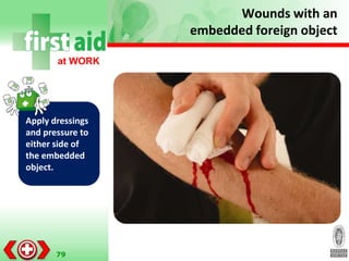 HABC Basic First Aid Training.ppt