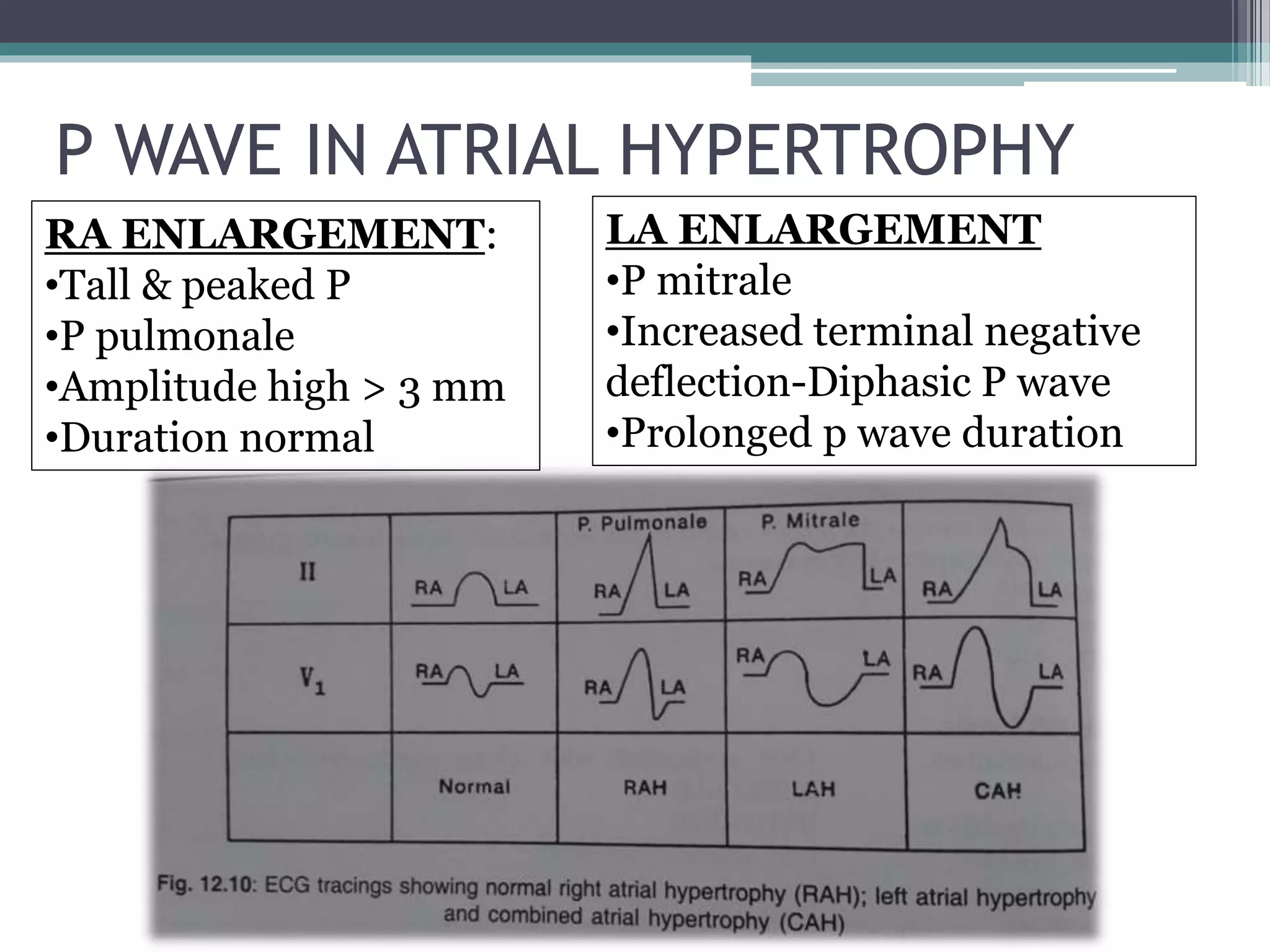 Pediatric ECG final.pptx
