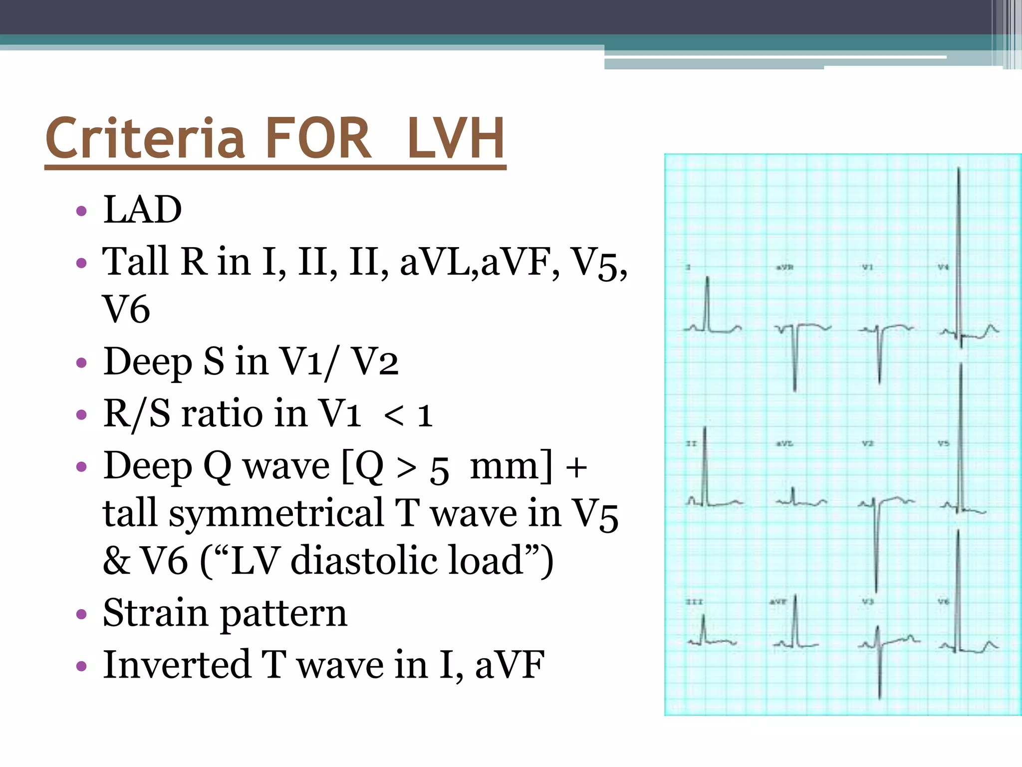 Pediatric ECG final.pptx