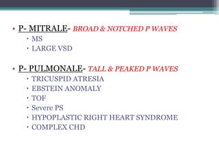 • P- MITRALE- BROAD & NOTCHED P WAVES
 MS
 LARGE VSD
• P- PULMONALE- TALL & PEAKED P WAVES
 TRICUSPID ATRESIA
 EBSTEIN ANOMALY
 TOF
 Severe PS
 HYPOPLASTIC RIGHT HEART SYNDROME
 COMPLEX CHD
 