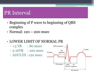PR Interval
• Beginning of P wave to beginning of QRS
complex
• Normal: 120 – 200 msec
• LOWER LIMIT OF NORMAL PR
▫ <3 YR : 80 msec
▫ 3-16YR : 100 msec
▫ ADULTS : 120 msec
 