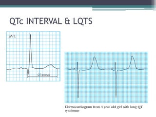 QTc INTERVAL & LQTS
 