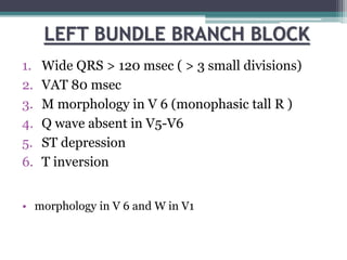 LEFT BUNDLE BRANCH BLOCK
1. Wide QRS > 120 msec ( > 3 small divisions)
2. VAT 80 msec
3. M morphology in V 6 (monophasic tall R )
4. Q wave absent in V5-V6
5. ST depression
6. T inversion
• morphology in V 6 and W in V1
 