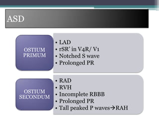 ASD
• LAD
• rSR’ in V4R/ V1
• Notched S wave
• Prolonged PR
OSTIUM
PRIMUM
• RAD
• RVH
• Incomplete RBBB
• Prolonged PR
• Tall peaked P wavesRAH
OSTIUM
SECONDUM
 