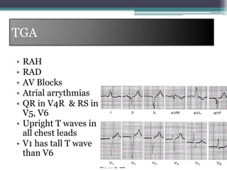 Pediatric ECG final.pptx